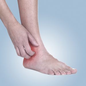 טיפול באקזמה