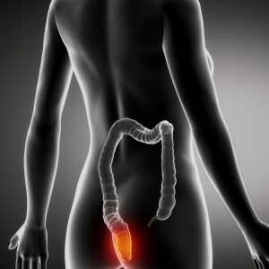 טיפול בטחורים