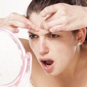 טיפול באקנה