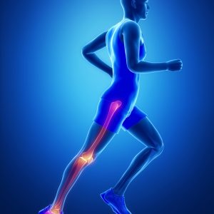 טיפול בדלקת גידים