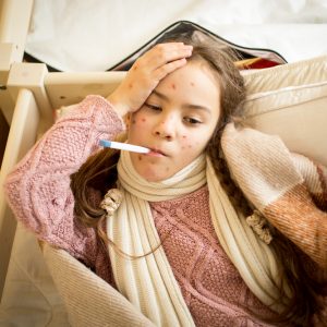 טיפול באבעבועות רוח