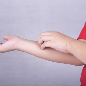 טיפול בגרד בעור