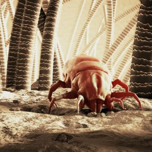 טיפול באסטמה בעור