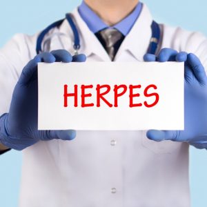 טיפול בהרפס