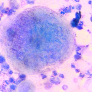 טיפול בהרפס